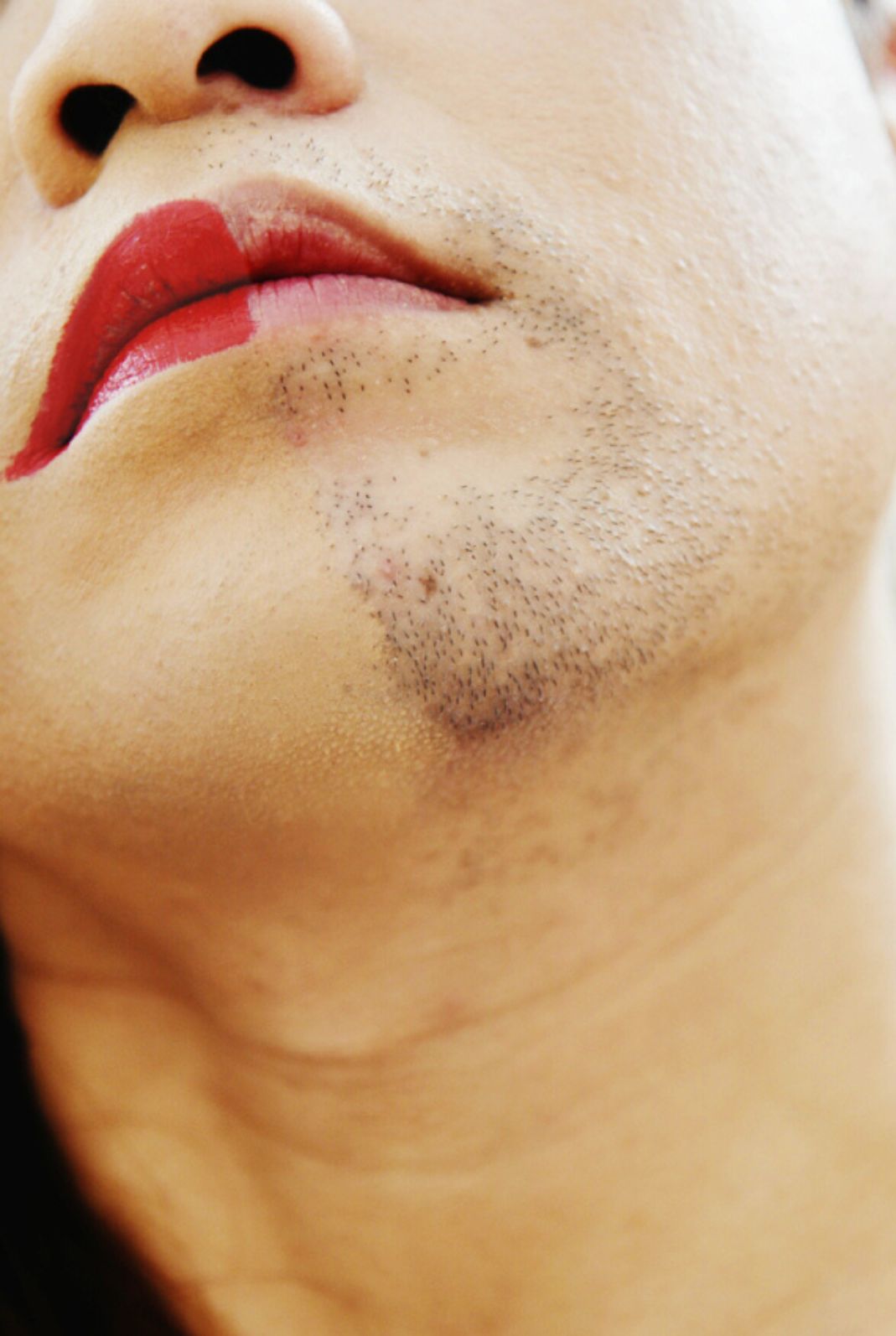 Transgenre : accompagner les changements de la peau